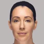 Dermal-Fillers-After-Photo-by-Harpe-Laser-&-Wellness-in-Asheville-NC A woman with a headband is smiling for the camera.