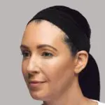 ba-filler-1-after 02 A woman with long hair wearing a black headband.