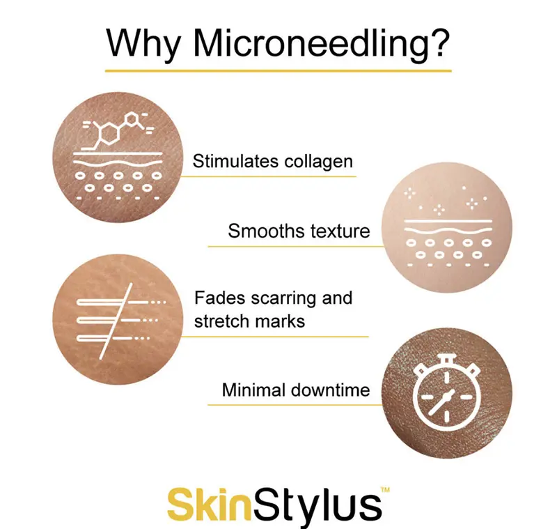 A chart showing the benefits of microneedling.