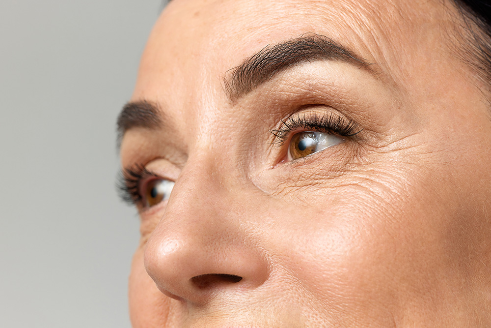 Wrinkle Treatment in Asheville & Hendersonville