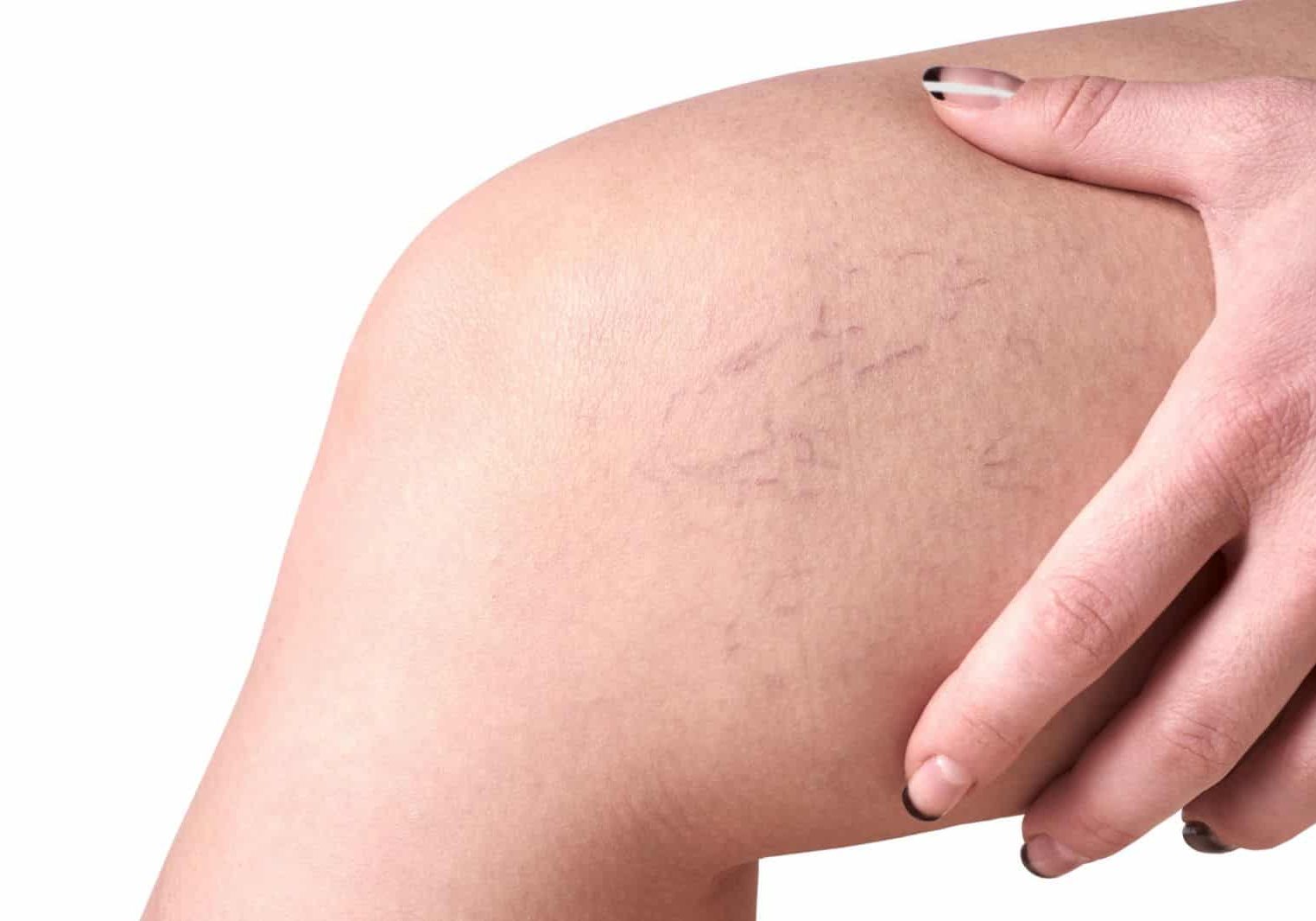 A person with their arm around another persons elbow.